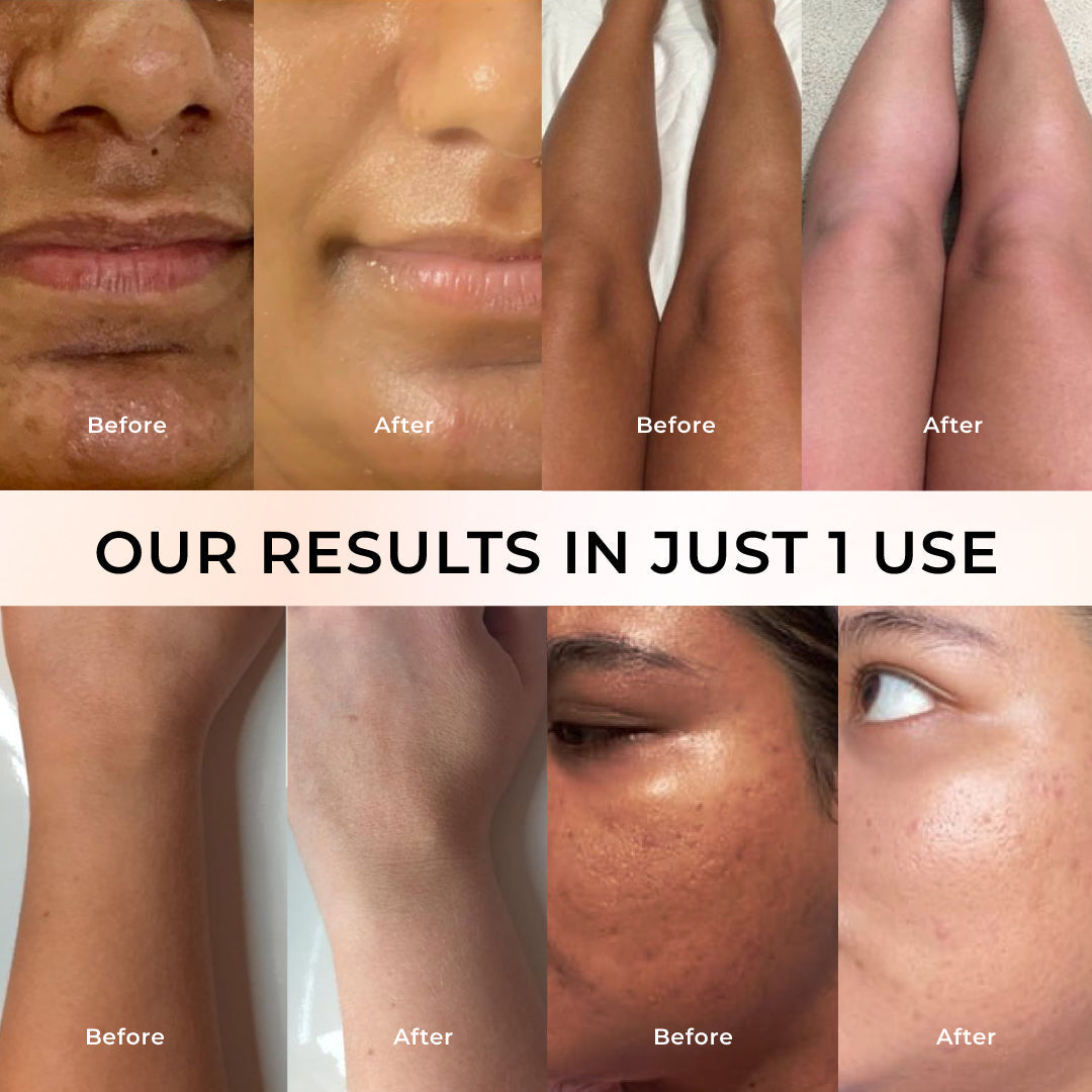 Niconi Tan Vanish Gluta-Kojic